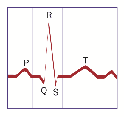 Figure 2 for Predicting Pulmonary Hypertension by Electrocardiograms Using Machine Learning