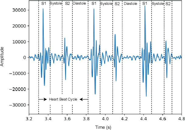 Figure 3 for A Comprehensive Survey on Heart Sound Analysis in the Deep Learning Era