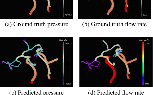 Figure 2 for Graph Neural Network for Cerebral Blood Flow Prediction With Clinical Datasets