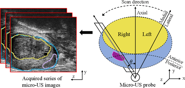 Figure 3 for Mask Enhanced Deeply Supervised Prostate Cancer Detection on B-mode Micro-Ultrasound