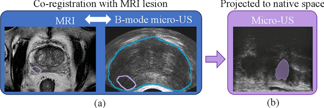 Figure 4 for Mask Enhanced Deeply Supervised Prostate Cancer Detection on B-mode Micro-Ultrasound