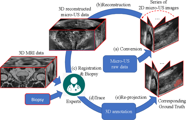 Figure 2 for Mask Enhanced Deeply Supervised Prostate Cancer Detection on B-mode Micro-Ultrasound