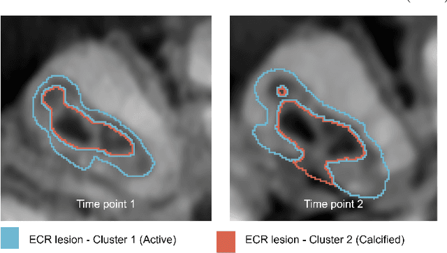 Figure 4 for Automated external cervical resorption segmentation in cone-beam CT using local texture features