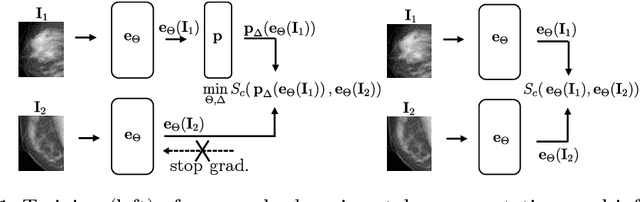 Figure 1 for StyleX: A Trainable Metric for X-ray Style Distances