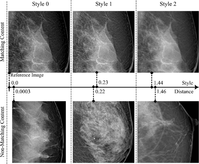 Figure 4 for StyleX: A Trainable Metric for X-ray Style Distances
