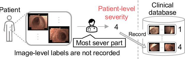 Figure 1 for Ordinal Multiple-instance Learning for Ulcerative Colitis Severity Estimation with Selective Aggregated Transformer