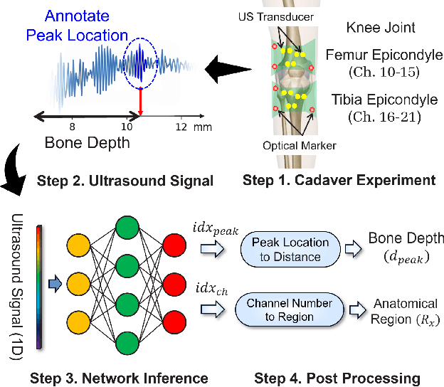 Figure 1 for Anatomical Region Recognition and Real-time Bone Tracking Methods by Dynamically Decoding A-Mode Ultrasound Signals