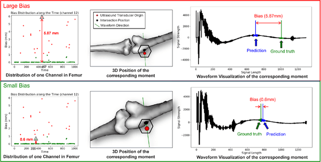 Figure 3 for Anatomical Region Recognition and Real-time Bone Tracking Methods by Dynamically Decoding A-Mode Ultrasound Signals