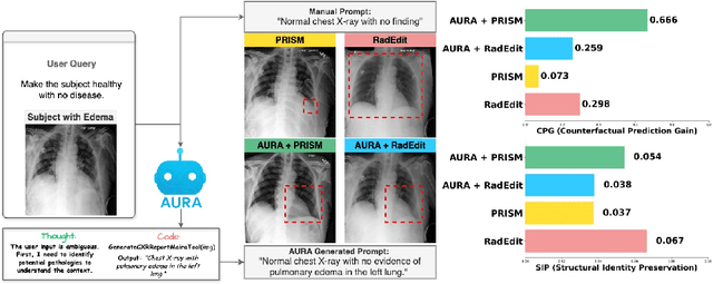 Figure 4 for AURA: A Multi-Modal Medical Agent for Understanding, Reasoning & Annotation