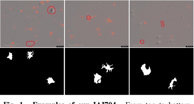 Figure 1 for FDNet: Frequency Domain Denoising Network For Cell Segmentation in Astrocytes Derived From Induced Pluripotent Stem Cells