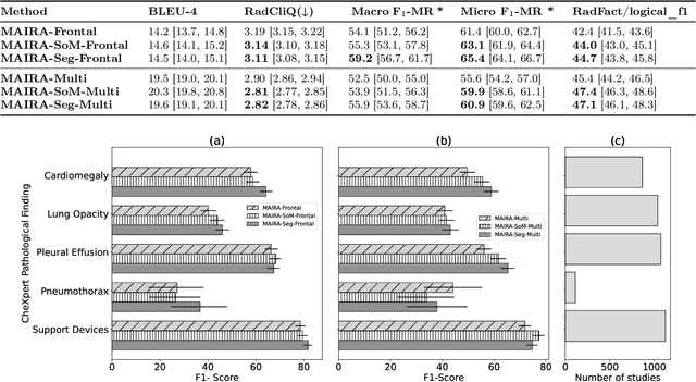 Figure 2 for MAIRA-Seg: Enhancing Radiology Report Generation with Segmentation-Aware Multimodal Large Language Models