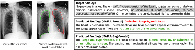 Figure 4 for MAIRA-Seg: Enhancing Radiology Report Generation with Segmentation-Aware Multimodal Large Language Models