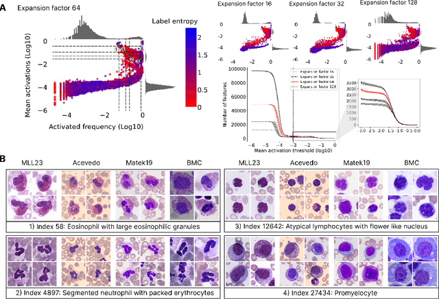 Figure 2 for CytoSAE: Interpretable Cell Embeddings for Hematology