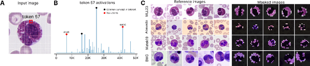 Figure 3 for CytoSAE: Interpretable Cell Embeddings for Hematology