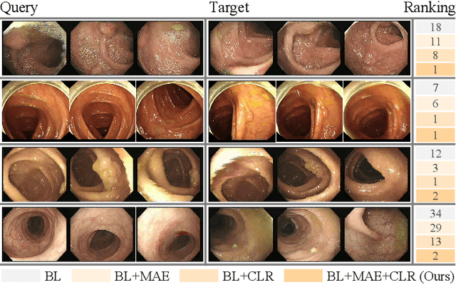 Figure 4 for Colo-SCRL: Self-Supervised Contrastive Representation Learning for Colonoscopic Video Retrieval