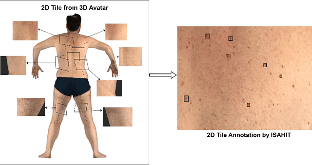 Figure 3 for The iToBoS dataset: skin region images extracted from 3D total body photographs for lesion detection