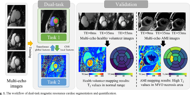 Figure 1 for Simultaneous Deep Learning of Myocardium Segmentation and T2 Quantification for Acute Myocardial Infarction MRI