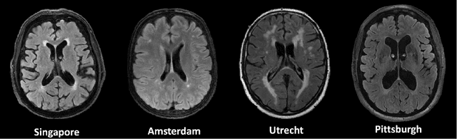 Figure 2 for wmh_seg: Transformer based U-Net for Robust and Automatic White Matter Hyperintensity Segmentation across 1.5T, 3T and 7T