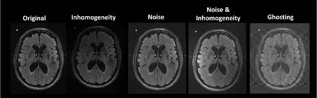Figure 3 for wmh_seg: Transformer based U-Net for Robust and Automatic White Matter Hyperintensity Segmentation across 1.5T, 3T and 7T