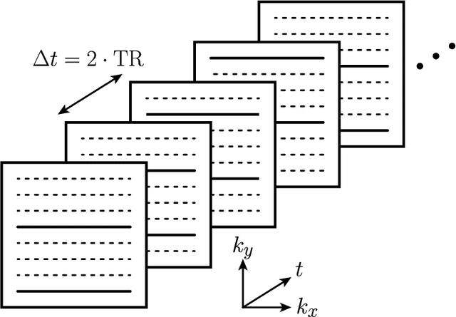 Figure 4 for Time-Resolved Reconstruction of Motion, Force, and Stiffness using Spectro-Dynamic MRI