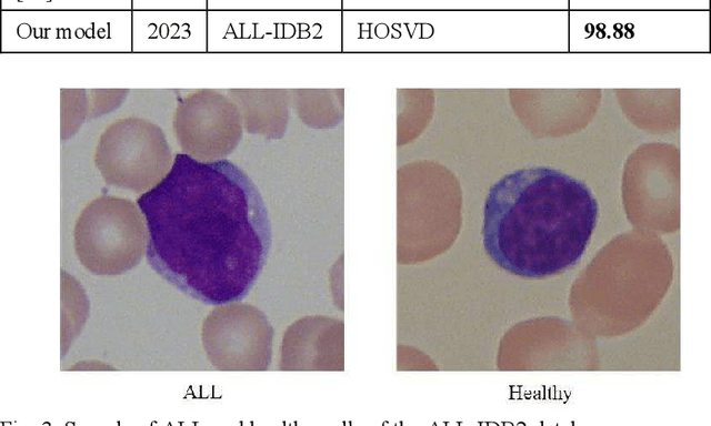 Figure 2 for IoMT-based Automated Leukemia Classification using CNN and Higher Order Singular Value