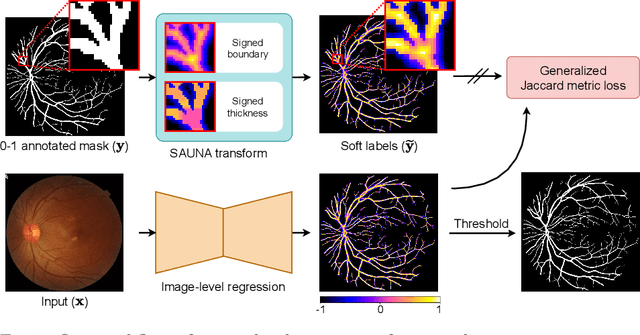 Figure 1 for Image-level Regression for Uncertainty-aware Retinal Image Segmentation