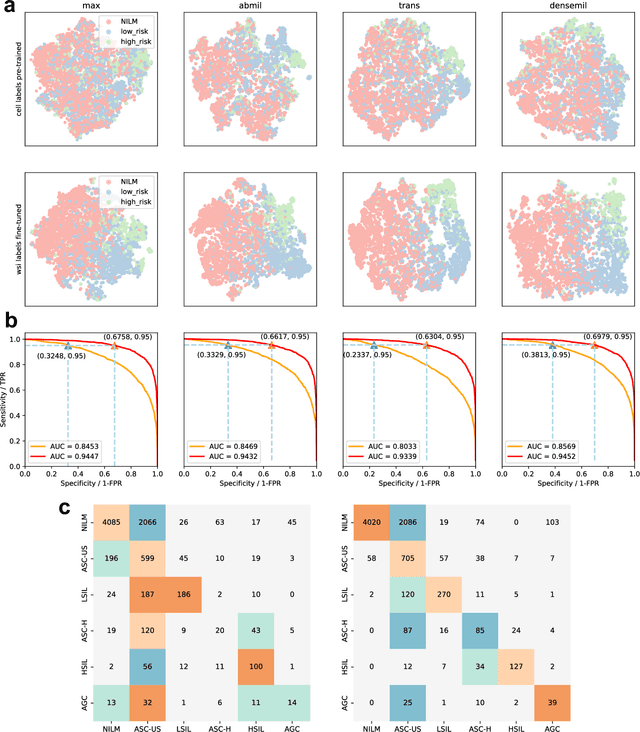 Figure 3 for Large-scale cervical precancerous screening via AI-assisted cytology whole slide image analysis