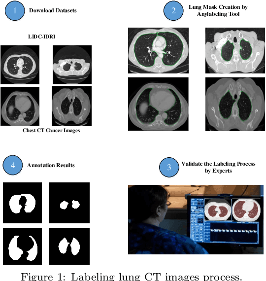 Figure 1 for FusionLungNet: Multi-scale Fusion Convolution with Refinement Network for Lung CT Image Segmentation