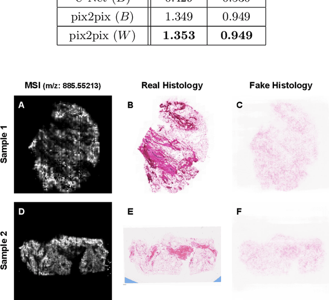 Figure 1 for Deep histological synthesis from mass spectrometry imaging for multimodal registration