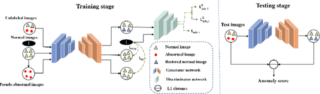 Figure 1 for Spatial-aware Attention Generative Adversarial Network for Semi-supervised Anomaly Detection in Medical Image