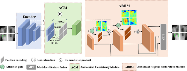 Figure 3 for Spatial-aware Attention Generative Adversarial Network for Semi-supervised Anomaly Detection in Medical Image
