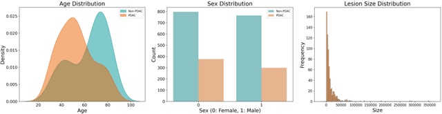 Figure 1 for AI-assisted Early Detection of Pancreatic Ductal Adenocarcinoma on Contrast-enhanced CT