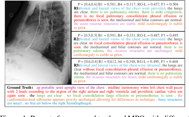 Figure 4 for Radiology Report Generation via Multi-objective Preference Optimization