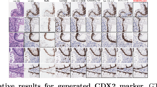 Figure 3 for Structural Cycle GAN for Virtual Immunohistochemistry Staining of Gland Markers in the Colon