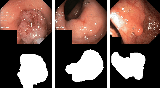 Figure 2 for Meta-Polyp: a baseline for efficient Polyp segmentation