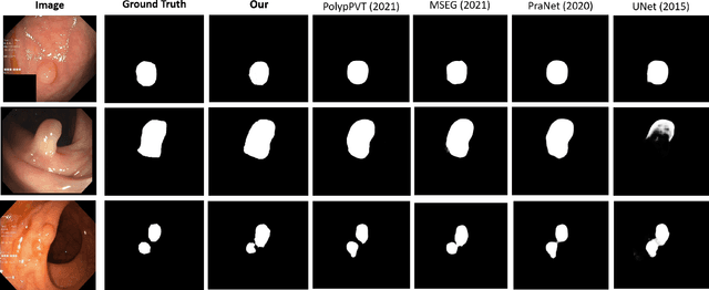 Figure 4 for Meta-Polyp: a baseline for efficient Polyp segmentation