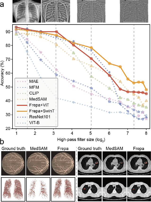 Figure 1 for Improving Representation of High-frequency Components for Medical Foundation Models