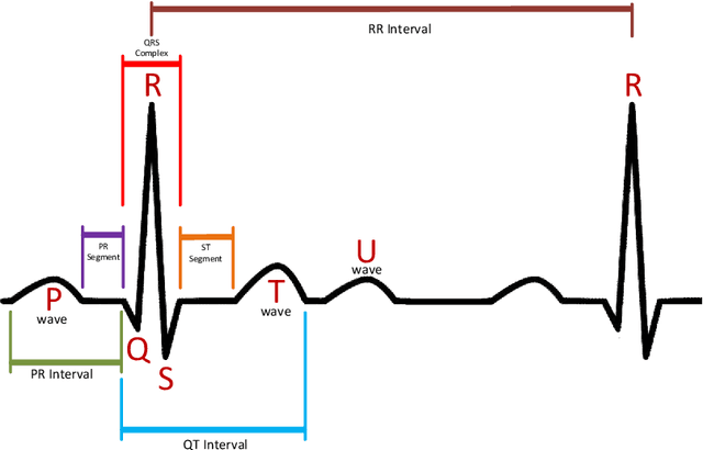 Figure 1 for A Cluster-Based Opposition Differential Evolution Algorithm Boosted by a Local Search for ECG Signal Classification