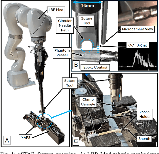 Figure 1 for Autonomous Robotic System with Optical Coherence Tomography Guidance for Vascular Anastomosis