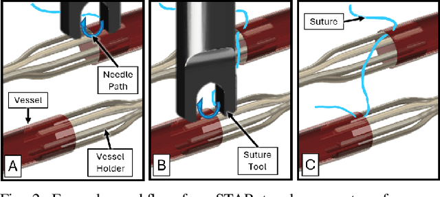 Figure 2 for Autonomous Robotic System with Optical Coherence Tomography Guidance for Vascular Anastomosis