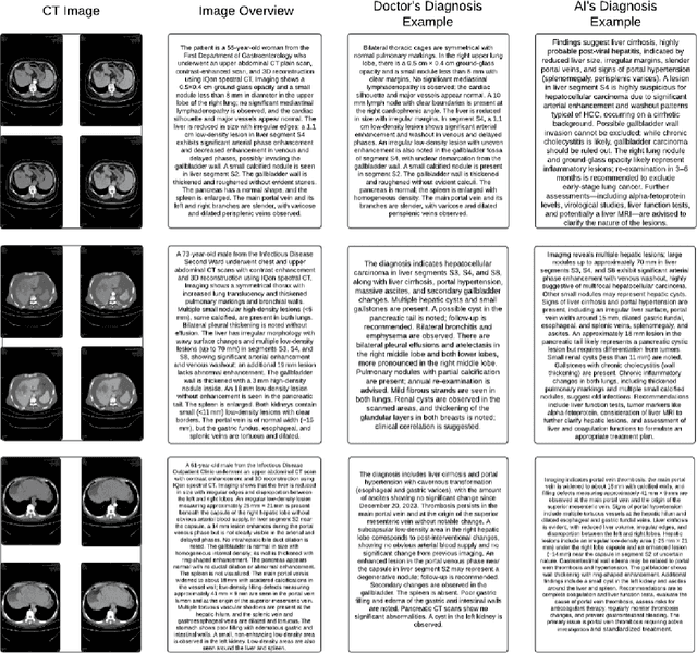 Figure 2 for Comprehensive Evaluation of Multimodal AI Models in Medical Imaging Diagnosis: From Data Augmentation to Preference-Based Comparison