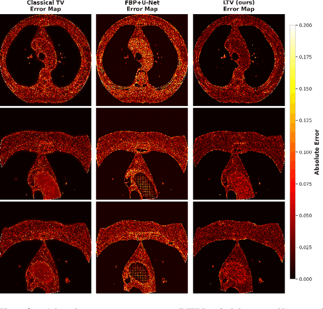Figure 3 for Learnable Total Variation with Lambda Mapping for Low-Dose CT Denoising