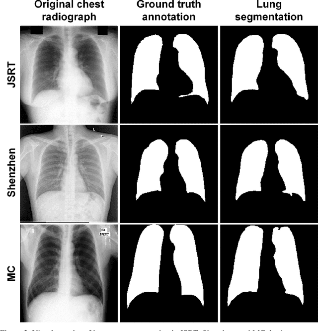 Figure 4 for Leveraging Anatomical Constraints with Uncertainty for Pneumothorax Segmentation