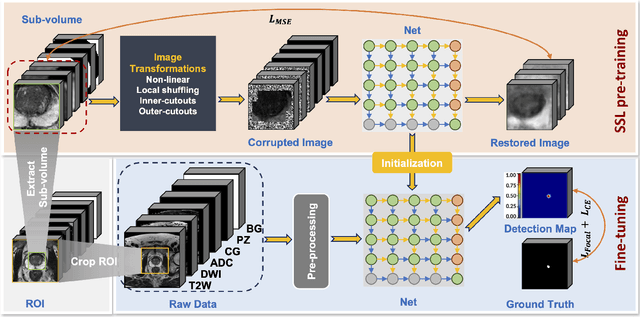 Figure 1 for Z-SSMNet: A Zonal-aware Self-Supervised Mesh Network for Prostate Cancer Detection and Diagnosis in bpMRI