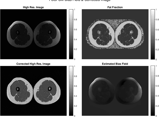 Figure 3 for A Geometric Flow Approach for Segmentation of Images with Inhomongeneous Intensity and Missing Boundaries