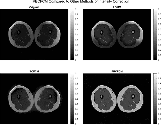 Figure 1 for A Geometric Flow Approach for Segmentation of Images with Inhomongeneous Intensity and Missing Boundaries