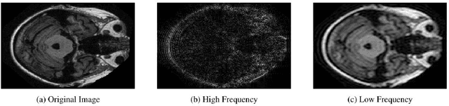 Figure 1 for DFT-Based Adversarial Attack Detection in MRI Brain Imaging: Enhancing Diagnostic Accuracy in Alzheimer's Case Studies