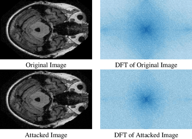 Figure 3 for DFT-Based Adversarial Attack Detection in MRI Brain Imaging: Enhancing Diagnostic Accuracy in Alzheimer's Case Studies