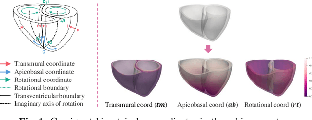 Figure 1 for Influence of Myocardial Infarction on QRS Properties: A Simulation Study