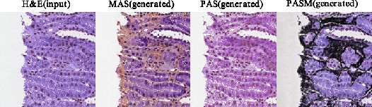 Figure 4 for Unpaired Multi-Domain Histopathology Virtual Staining using Dual Path Prompted Inversion